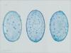humaria-hemisphaerica_04_t1.jpg