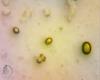 mycenapterigena_t1.jpg